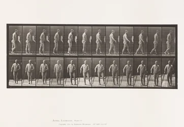 Placa 552. Hemiplejía; caminando con bastón, 1885