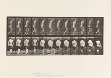 Placa 558. Paraplejía; parcial; caminando, 1885