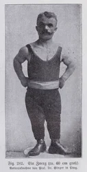 Enanismo: hombre de 60 cm de altura de Praga