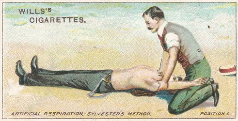 Respiración artificial, método de Sylvester - Posición 1, no.17 de la serie de primeros auxilios de las tarjetas de cigarrillos de Willss, 1913