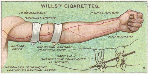 Torniquete, no.11 de la serie de primeros auxilios de las tarjetas de cigarrillos de Willss, 1913