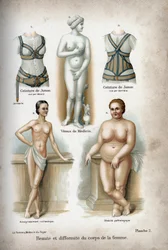 La belleza y la deformidad del cuerpo de la mujer: una mujer demasiado delgada y una obesa representadas por debajo de la Venus de Médicis, considerada la "mujer ideal".