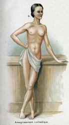 Retrato de una mujer con pérdida de peso caquéctica (impresión)