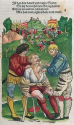 Extracción de una flecha, ilustración de Feldtbuch der Wundartzney por Hans von Gersdorff, 1540