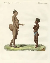 Variedades humanas extrañas