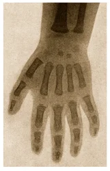 Radiografía de la mano de un niño c.1890