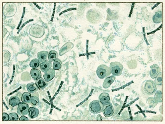Muestra de bacterias de ántrax en sangre c.1890