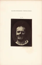 Electrofisiología fotográfica, Figura 53