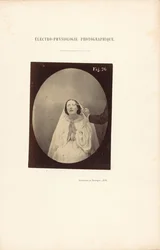 Electrofisiología fotográfica, Figura 76