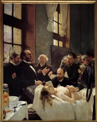 El Dr. Jules-Émile Péan (1830-1898) enseña en el Hospital Saint-Louis su descubrimiento del pinzamiento de los vasos. «Antes de la operación». Pintura de Henri Gervex (1852-1929), 1887. Al. 2,42 x 1,88 m, París, Museo de Orsay
