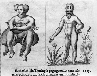 Diferentes tipos de monstruos humanos. Grabado de “De monstrorum natura, causis et differentiis” de Fortunio Liceti (1577-1656), científico italiano. 1646