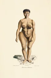 Boschman Race Woman Vista frontal