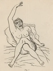 Epilepsia histérica, ataque, contorsiones, fig. 1 de 