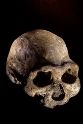 Cráneo de Homo erectus, desdentado, Dmanisi, Georgia Yacimiento de Homo erectus