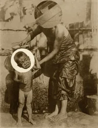 Marca de nacimiento (Salomé)