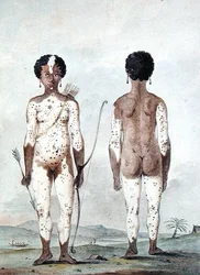 «Niña negra nacida en Lille, Santa Lucía», hacia 1795