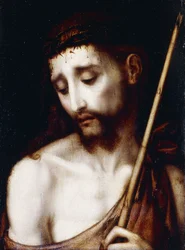 El hombre de dolores