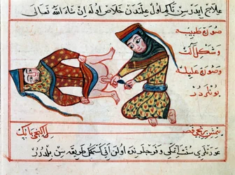 Medicina: operación de un hermafrodita. Miniatura de un tratado de medicina turca de Sharaf al-din