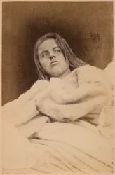 Epilepsia histérica, alucinaciones, desdén, lámina XXXI de 