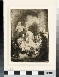 La circuncisión