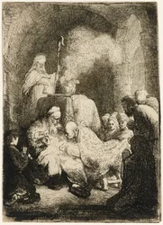 La circuncisión: placa pequeña