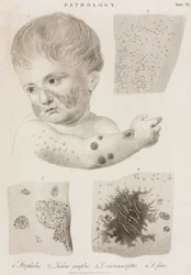 Dermatología Tipos de enfermedades de la piel