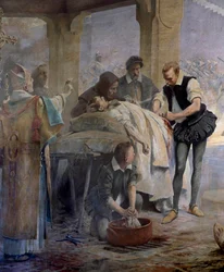 El doctor Ambroise Paré practica la ligadura de las arterias en un arcabucero herido durante el asedio de Metz por Carlos V en 1553 (detalle)