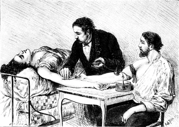 El Dr. Roussell de Ginebra realizando una transfusión de sangre directa a una mujer de un voluntario, 1882