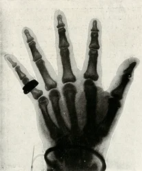 Radiografía de la mano de S.A.R. El Príncipe de Gales, c. 1897