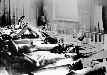 Supervivientes de la explosión de la bomba atómica en Hiroshima, Japón, 1945