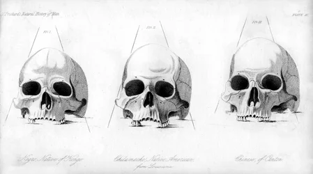 Tres tipos de cráneo humano, 1848
