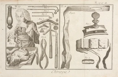 Trepanación
