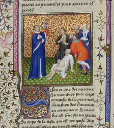 Ms.251 f.54v Un doctor con sus pacientes, de Des Proprietez des Choses, c.1415