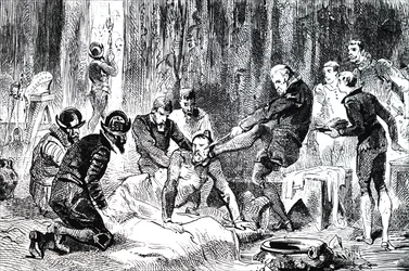 Ambroise Paré removiendo una lanza del rostro del Duque de Guisa