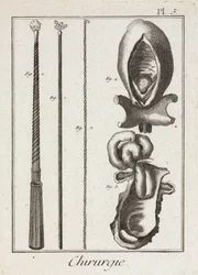 Equipamiento, Instrumentos quirúrgicos de la Edad Moderna y diagramas de partes del cuerpo