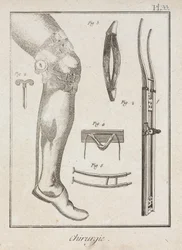 Equipamiento, Soportes quirúrgicos de la Edad Moderna