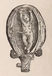 Partus non naturalis manibus funra canut porrectie