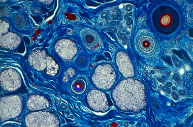 Piel humana vista bajo un microscopio, mostrando el tallo del cabello y los poros del sudor