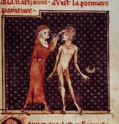 Figura anatómica: El cirujano incide la frente de un paciente. Miniatura del manuscrito “Cirugía” (Folio 8) escrito por Henri de Mondeville (cirujano de Philippe Le Bel profesor de anatomía)