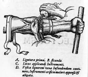 Lámina anatómica: diferentes ligaduras. Trabajo sobre el sistema sanguíneo por William Harvey (1578-1657), médico inglés. Describió la circulación de la sangre en el cuerpo a través de las venas