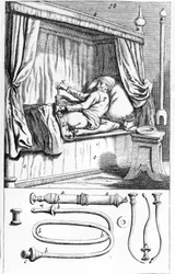 Clystère (para enemas) por Johannes Sculptetus 