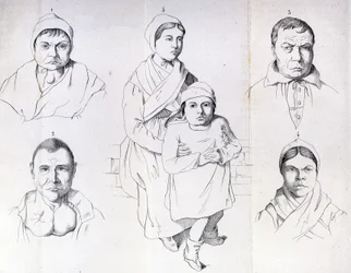 Consideraciones sobre las causas del cretinismo endémico por Morel.