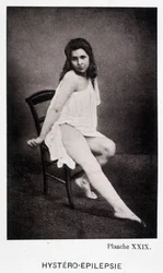 Hystero Epilepsie - Contractura en "Iconografía fotográfica de la Salpêtrière: servicio del Sr. Charcot" por Paul Regnard y Bourneville