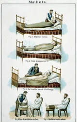 Jerseys: 1) Jersey total, 2) Baño de vapor en la cama, 3) Jersey corto de Kneipp, 4-5) Jersey de pantorrilla - en “Bilz, Medicación Natural”, finales del siglo XIX