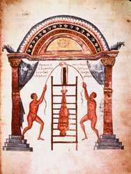 Reducción de una columna vertebral dislocada