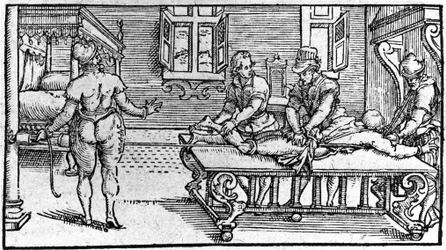 Reducción de una dislocación, en “Tratado Médico” de Ambroise Paré, circa 1560.