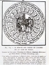 El espejo de la orina del hombre o “La clave del pulso” - grabado en madera en “La epifanía de los médicos” de Pinder (o Binder), Núremberg