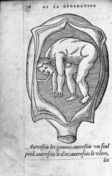 La posición del feto en el útero durante el embarazo. Grabado de “De la generación de los niños” del médico y cirujano francés Ambroise Paré (1509-1590) siglo XVI