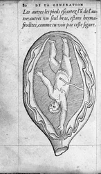 La posición del feto en el útero durante el embarazo. Grabado de “De la generación de los niños” del médico y cirujano francés Ambroise Paré (1509-1590) Siglo XVI