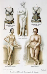 Belleza y deformidad del cuerpo de la mujer (delgadez y obesidad); cinturones de Juno - en "La mujer, médico del hogar"